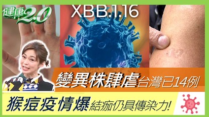 第2631集 變異株大角星肆虐29國 台灣已有14例！猴痘疫情爆 皮膚結痂仍具傳染力！